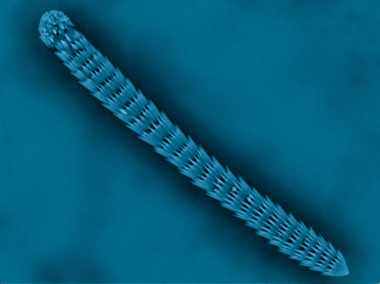 Just 10 micrometers in diameter, this sea squirt helped unlock the crystal structure of vaterite. Photo: Pupa U. P. A. Gilbert, Lee Kabalah-Amitai, Boaz Pokroy